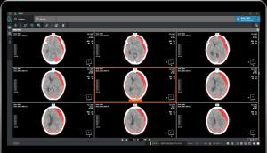 Coreline Soft Demonstrates Non-Payable AI Profit Model... Accelerate 'Emergency AI Package' strategy
