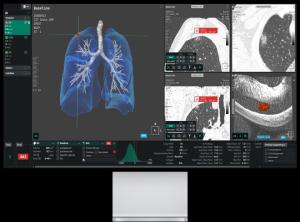 Coreline Soft’s AVIEW LCS Wins Government Innovation Status, Opens Public Procurement Path