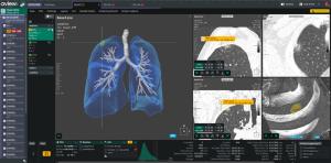 Coreline Soft to Showcase Clinical AI at KCR 2026, Expanding Beyond Detection to Screening and Follow-up Care